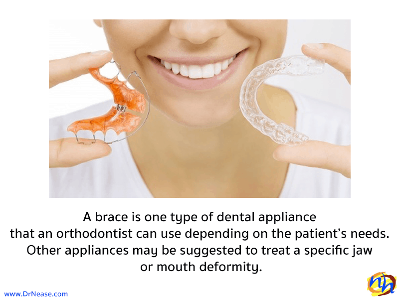 orthodontic facts