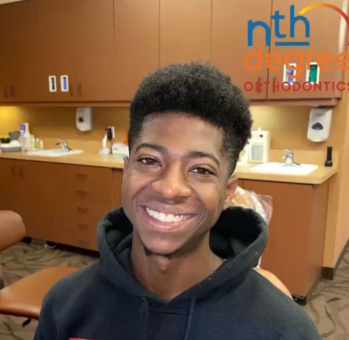 Our patient, Derrick smiles after seeing the results of his orthodontic treatment