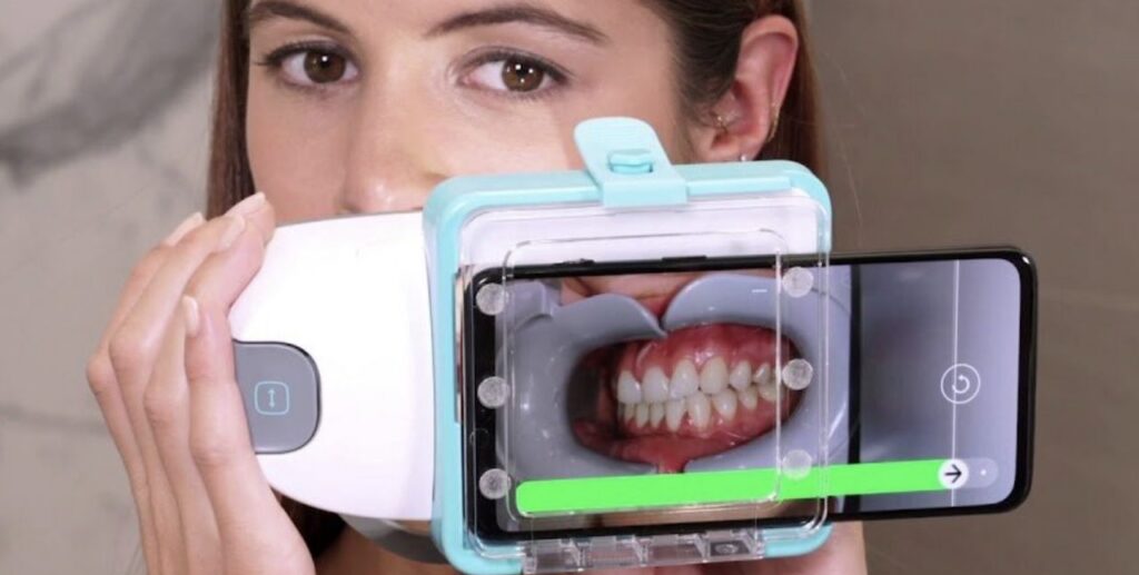 patient using virtual orthodontic software, dentalmonitoring for virtual check ins